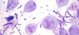 antimicrobial-stewardship-giardia