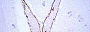 Primary Antibodies for Western Blotting