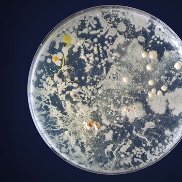 Petri Dish with Bacteria