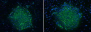 Optical Clearing for Improved Confocal Imaging of Thick Specimens